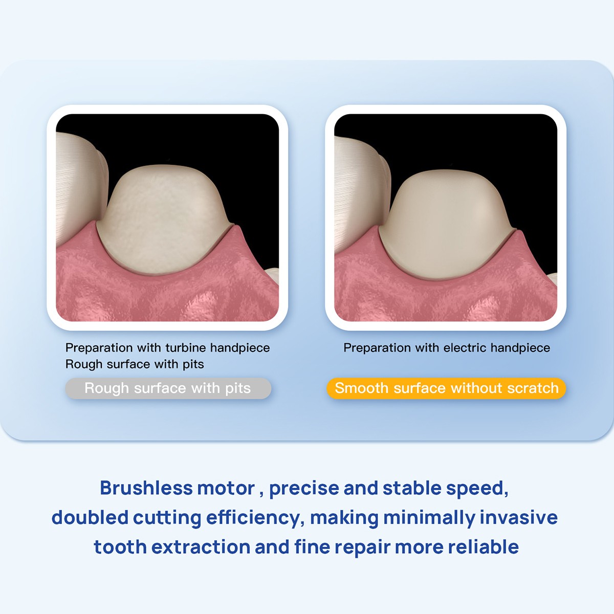 Brushless Dental Electric Micro Motor Water System/1:1 1:5 1:4.2 LED Handpiece