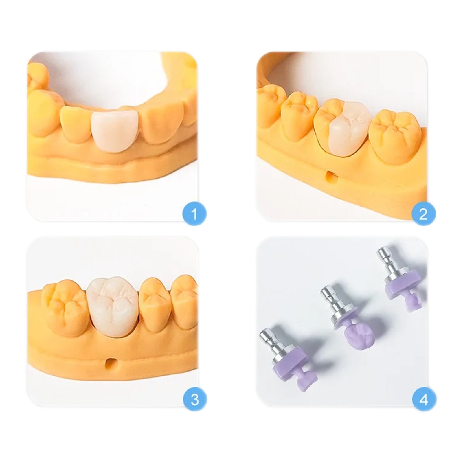 US Dental Emax Glass Ceramic Blocks C14 HT/LT Lithium Disilicate CAD/CAM CEREC