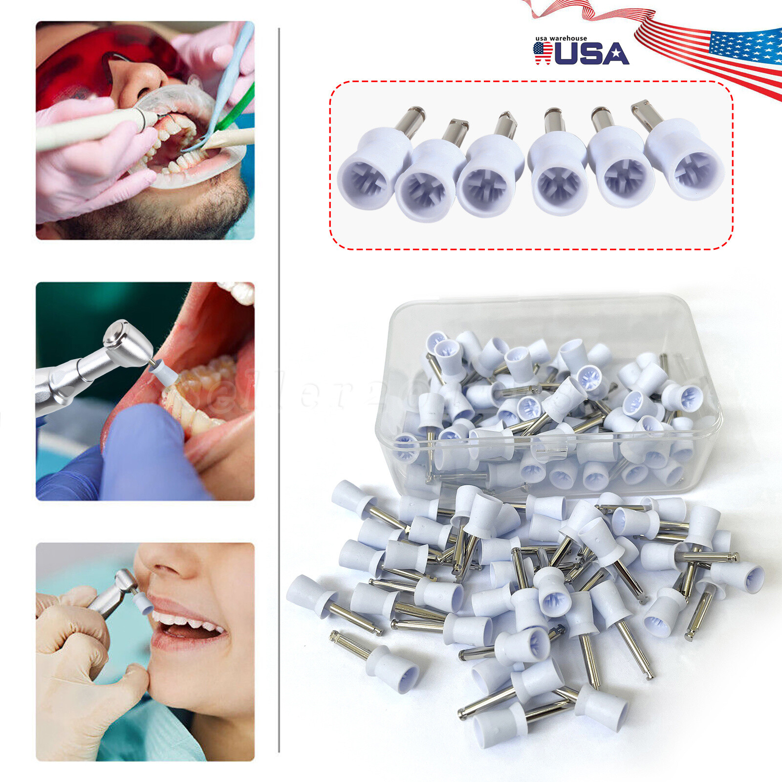 100 Pcs Polishing Cups Dental Rubber Prophy Tooth Polisher Brushes Kit white