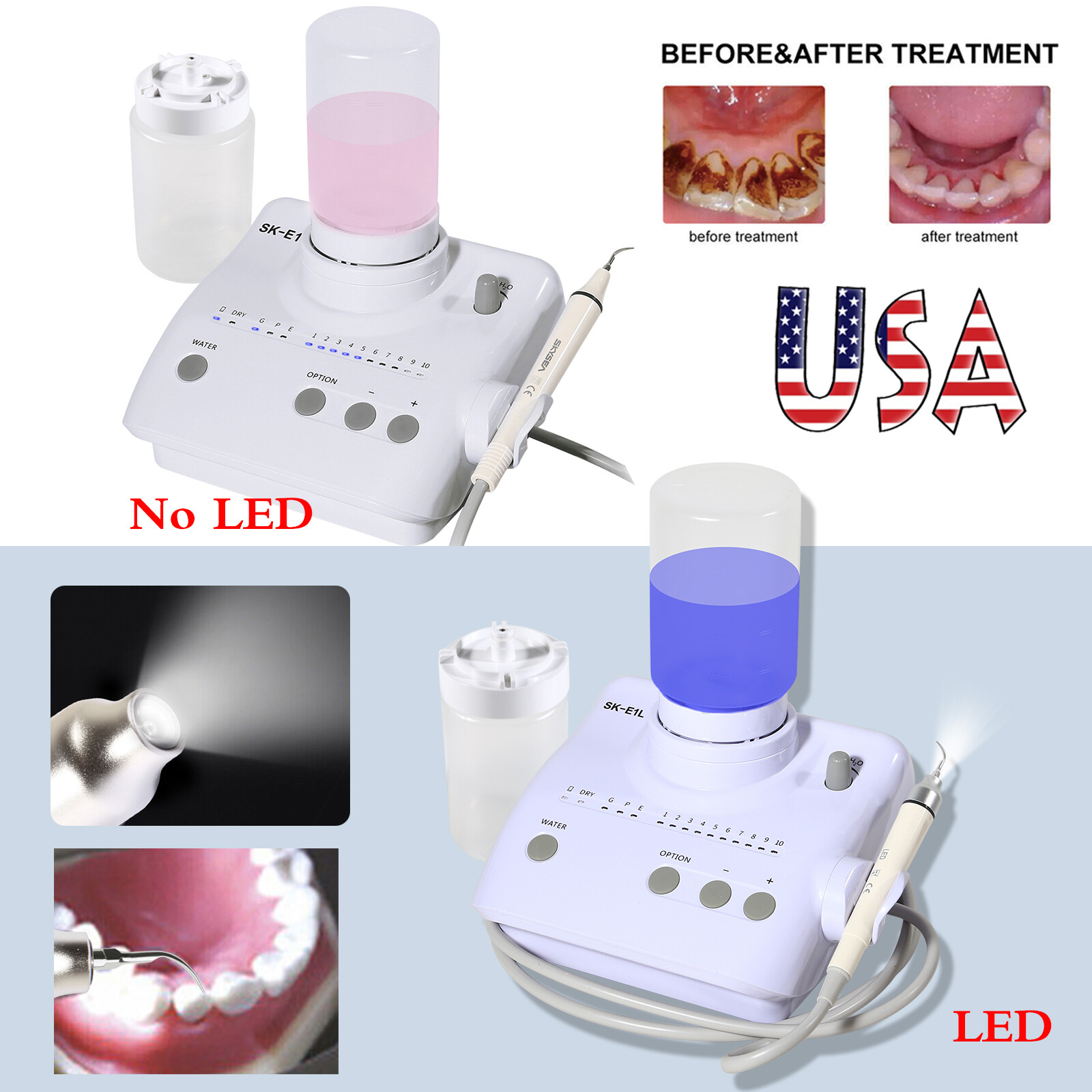 Ultrasonic Piezo Dental Scaler Handpiece 2*Bottles LED/NO-LED Fit EMS Cavitron E