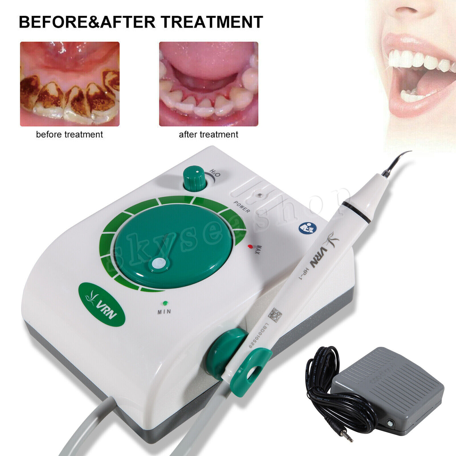 USA Dental Ultrasonic Piezo Scaler Handpiece 5 Tips Fit EMS Cavitron Woodpecker