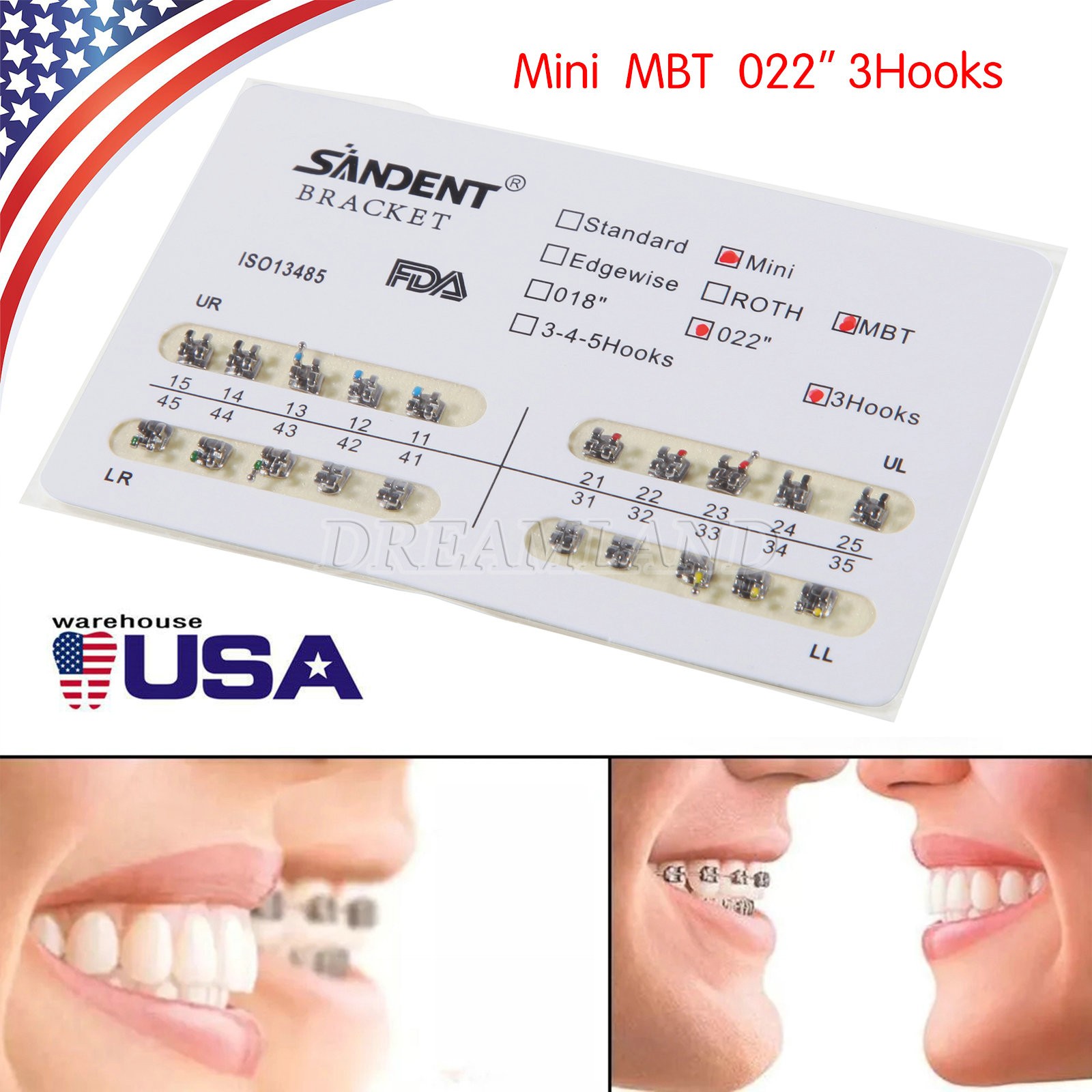 10kits SANDENT Dental Brackets Braces Orthodontic Mini MBT0.022″ Hooks 3-