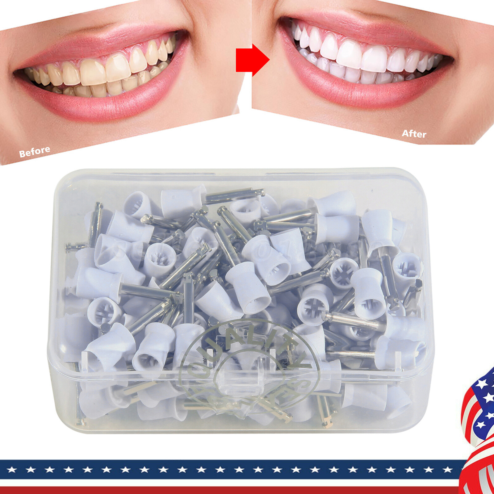 100 Pcs Polishing Cups Dental Rubber Prophy Tooth Polisher Brushes Kit white