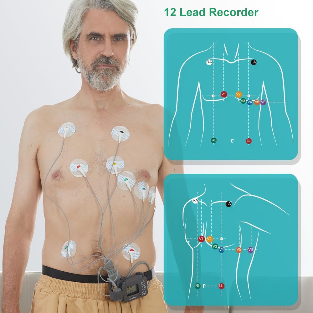 AI Analysis EKG Monitor Heart Monitor 30s/60s/5min Recording with App PC Report