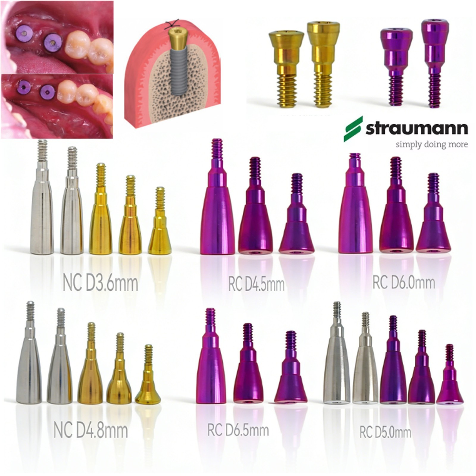 US Implant Accessories Healing Closure Abutment Fit Straumann ITI Dental Clinic