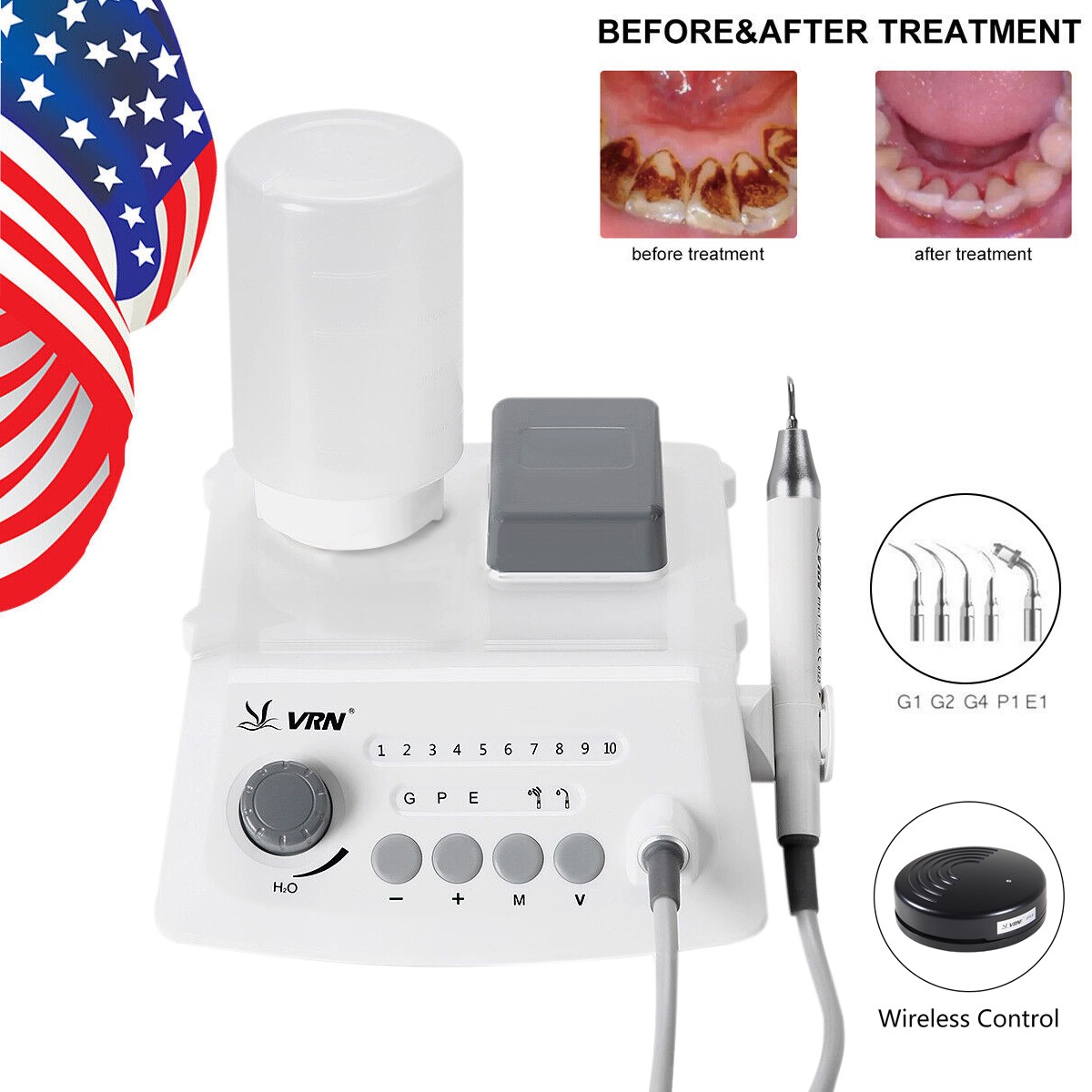 Veterinary Dental Scaler Machine With LED Handpiece Ultrasound Scaler. 5 Tips