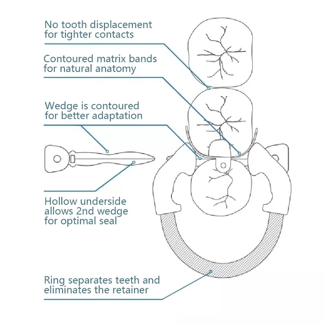 Dental Sectional Matrix Bands with Niti Clamps For Rubber Dam Autoclavable 135°C
