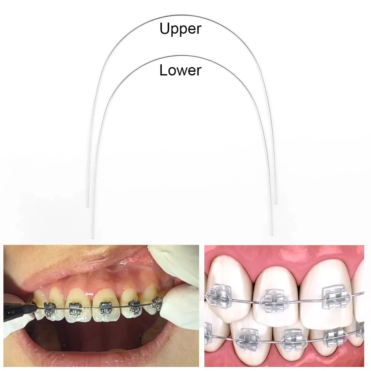 10 Pcs Dental Orthodontic Super Elastic Niti Arch Wire Round 012-020 Upper Lower