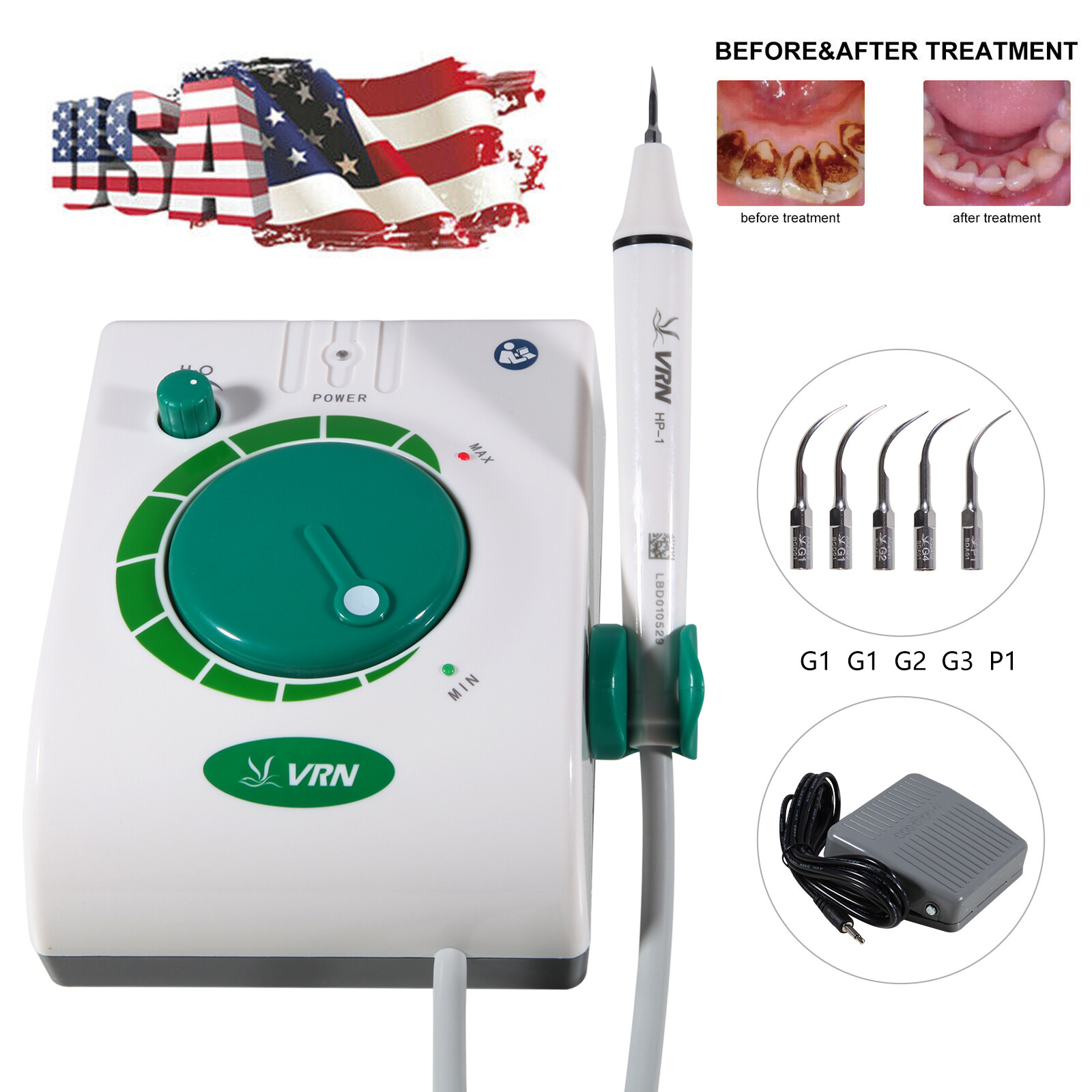 Dental Ultrasonic Piezo Scaler Handpiece / Ultrasonic Air Perio Scaler Handpiece