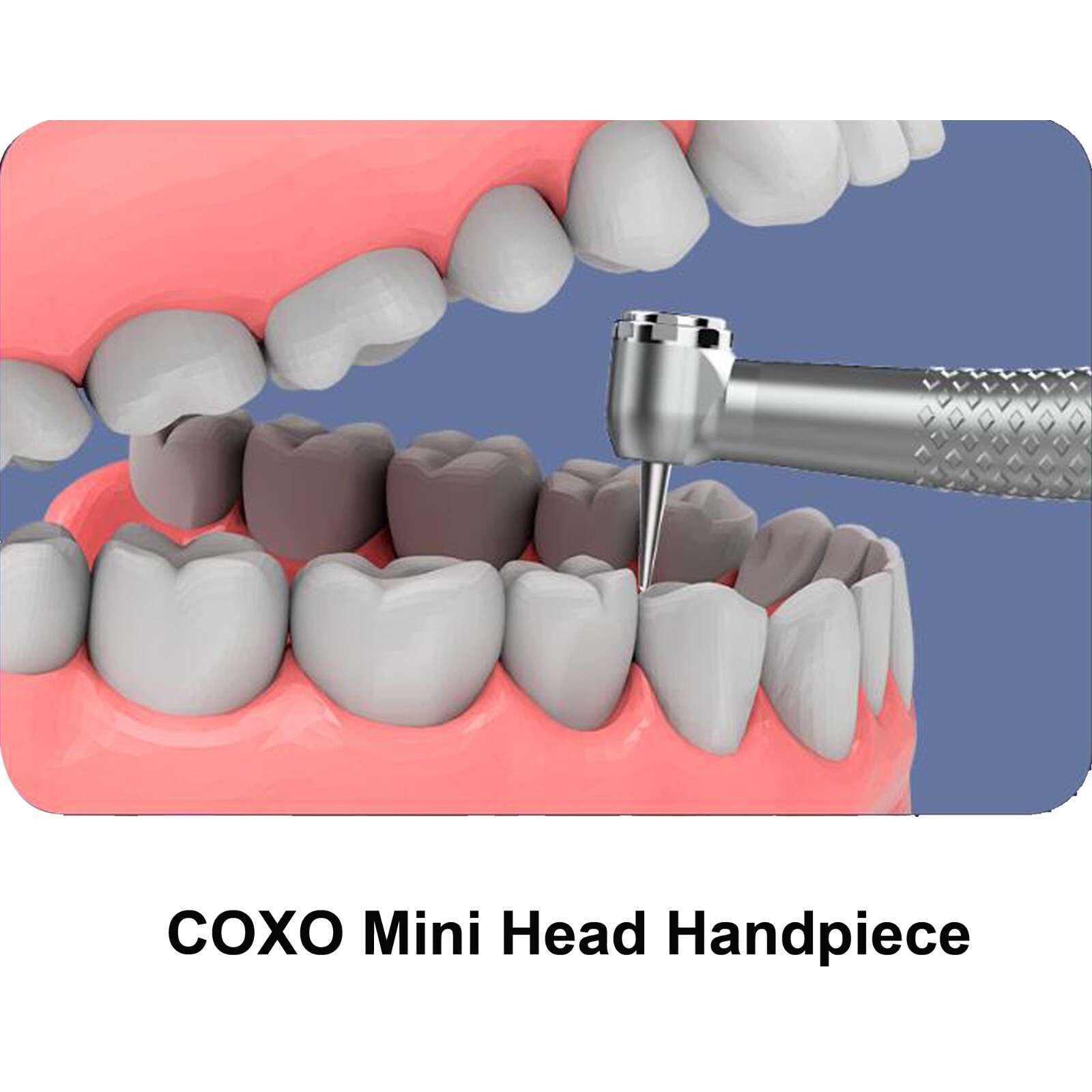 COXO Dental Handpiece Small High Speed Turbine 4Hole CX207-B NSK Ultra Mini Head