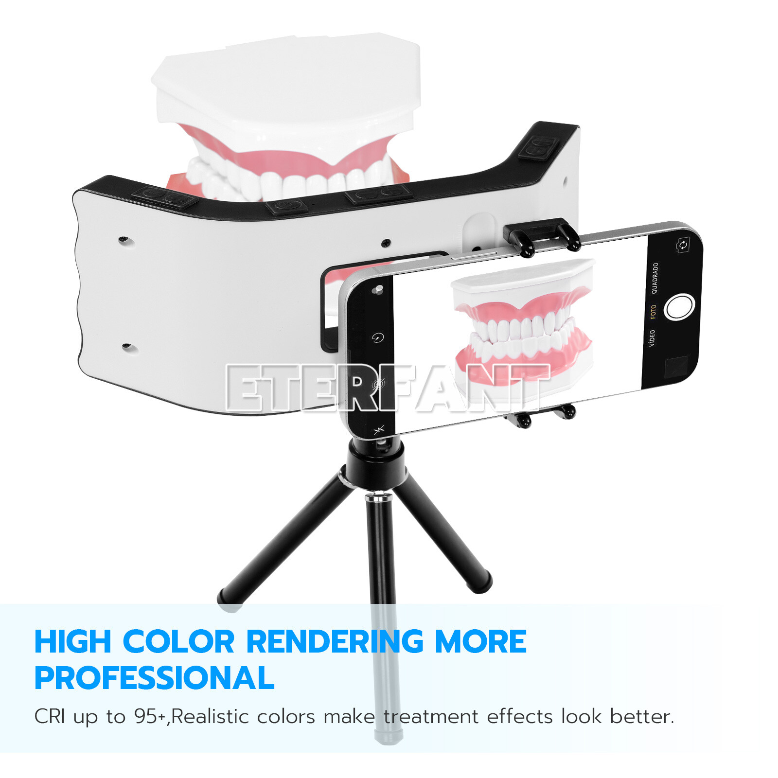 ETERFANT Dental Supplementary LED Lamp Oral Light Photography with Bracket