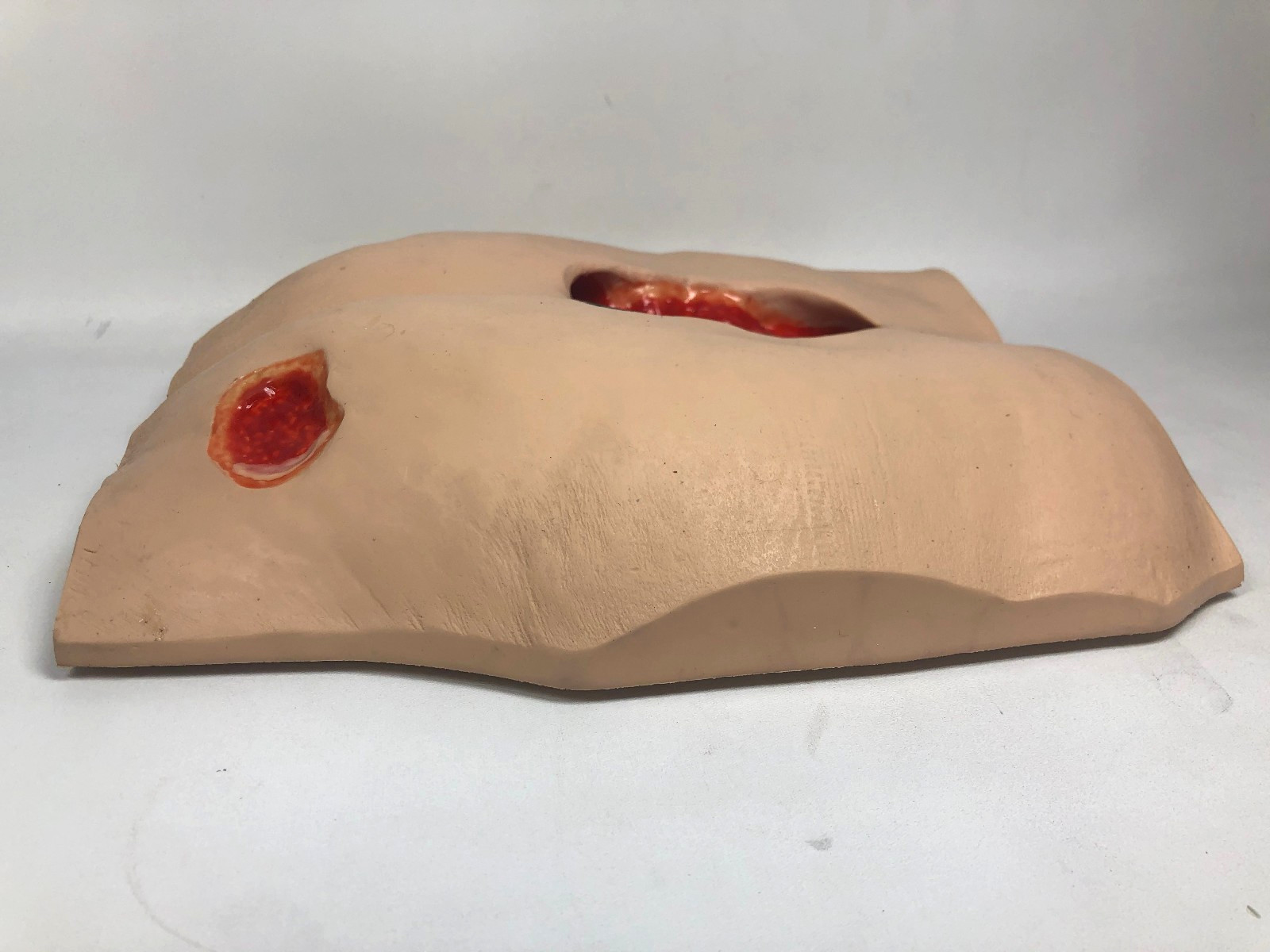 VATA ‘Stan’ Stage IV Pressure Ulcer Model 0970 with Carry Case