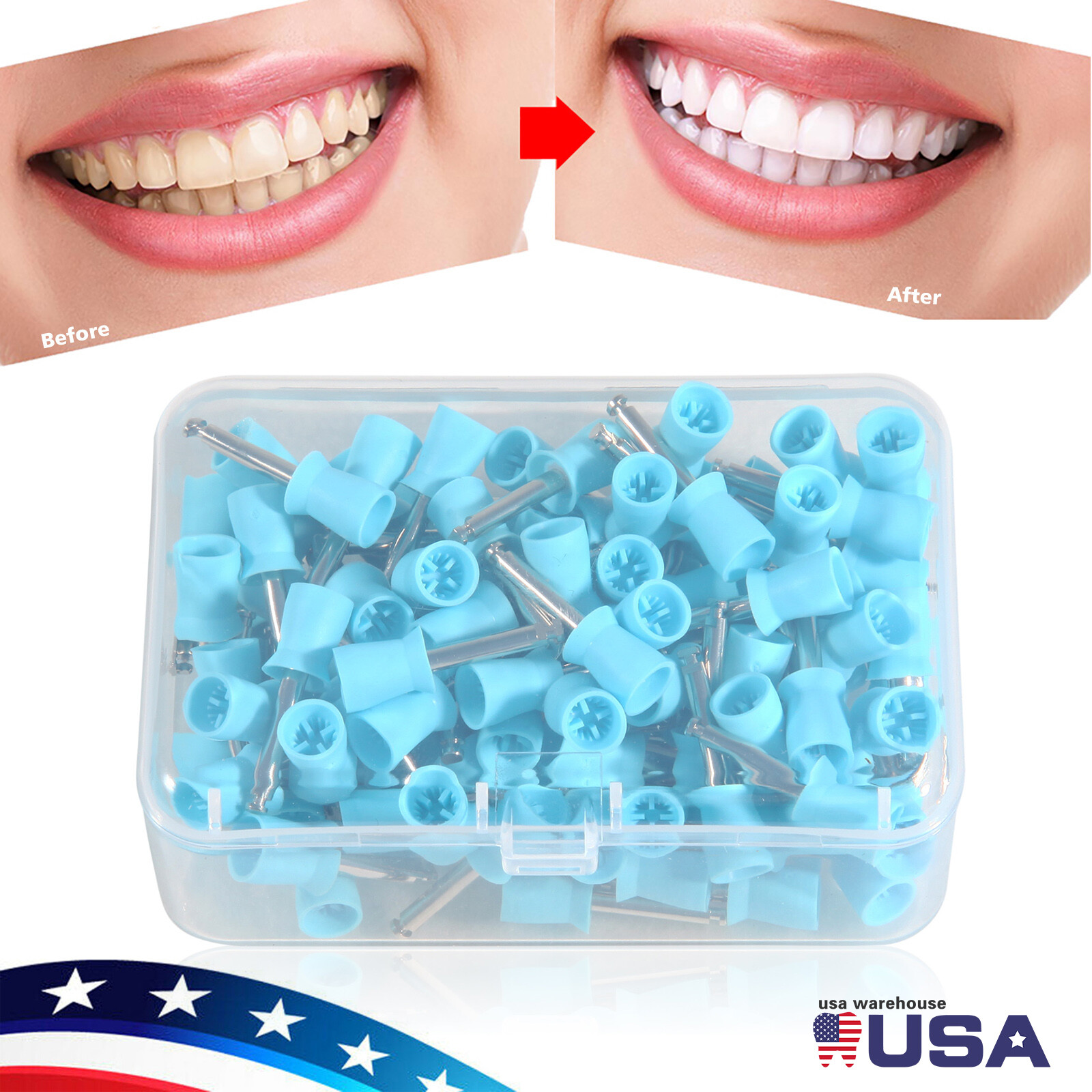 100X Dental Prophy Polishing Cups Latch Brushes for Contra Angle Handpiece MT