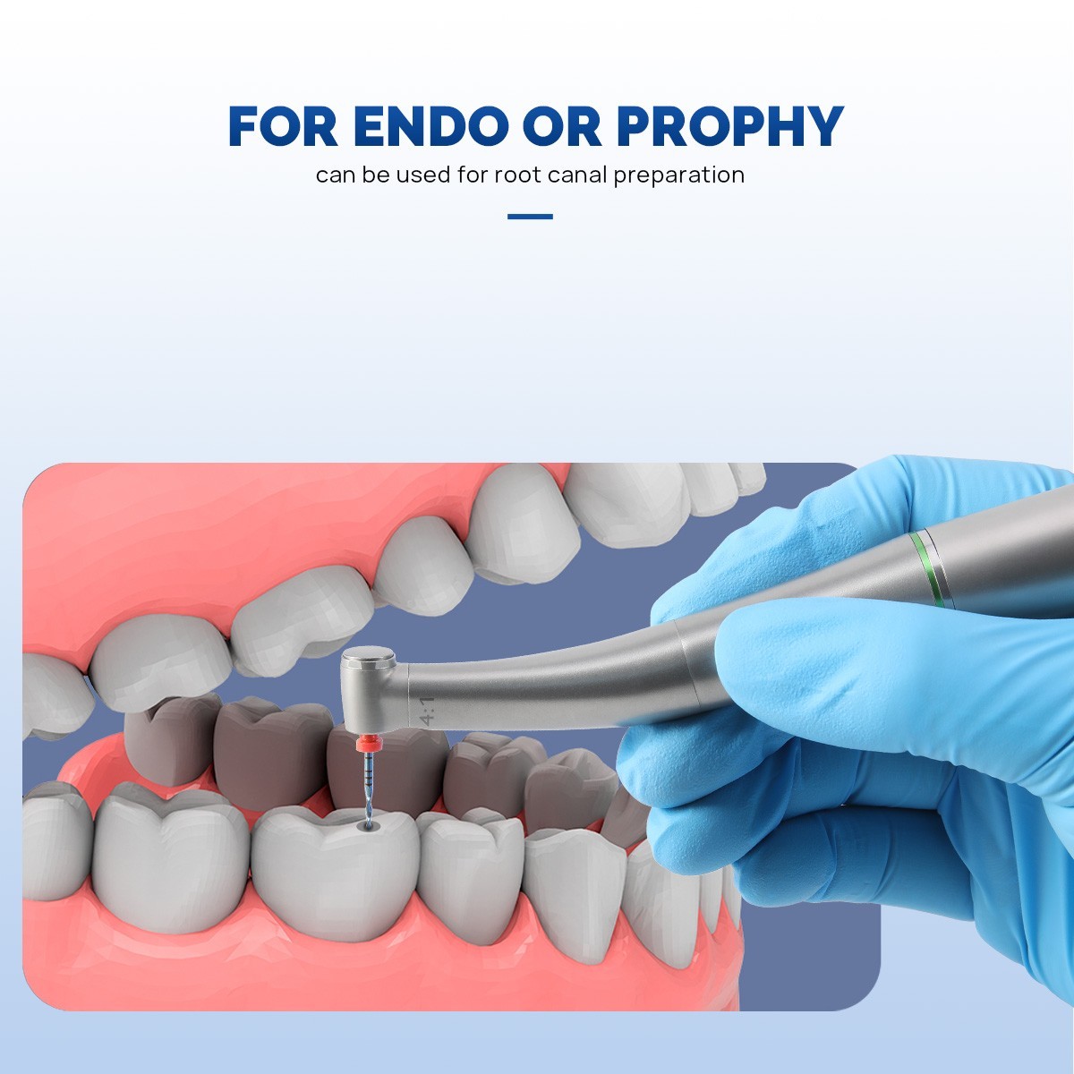 AZDENT Dental E-Type 4:1 Fiber Optic LED Endo & Prophy Contra Angle Handpiece