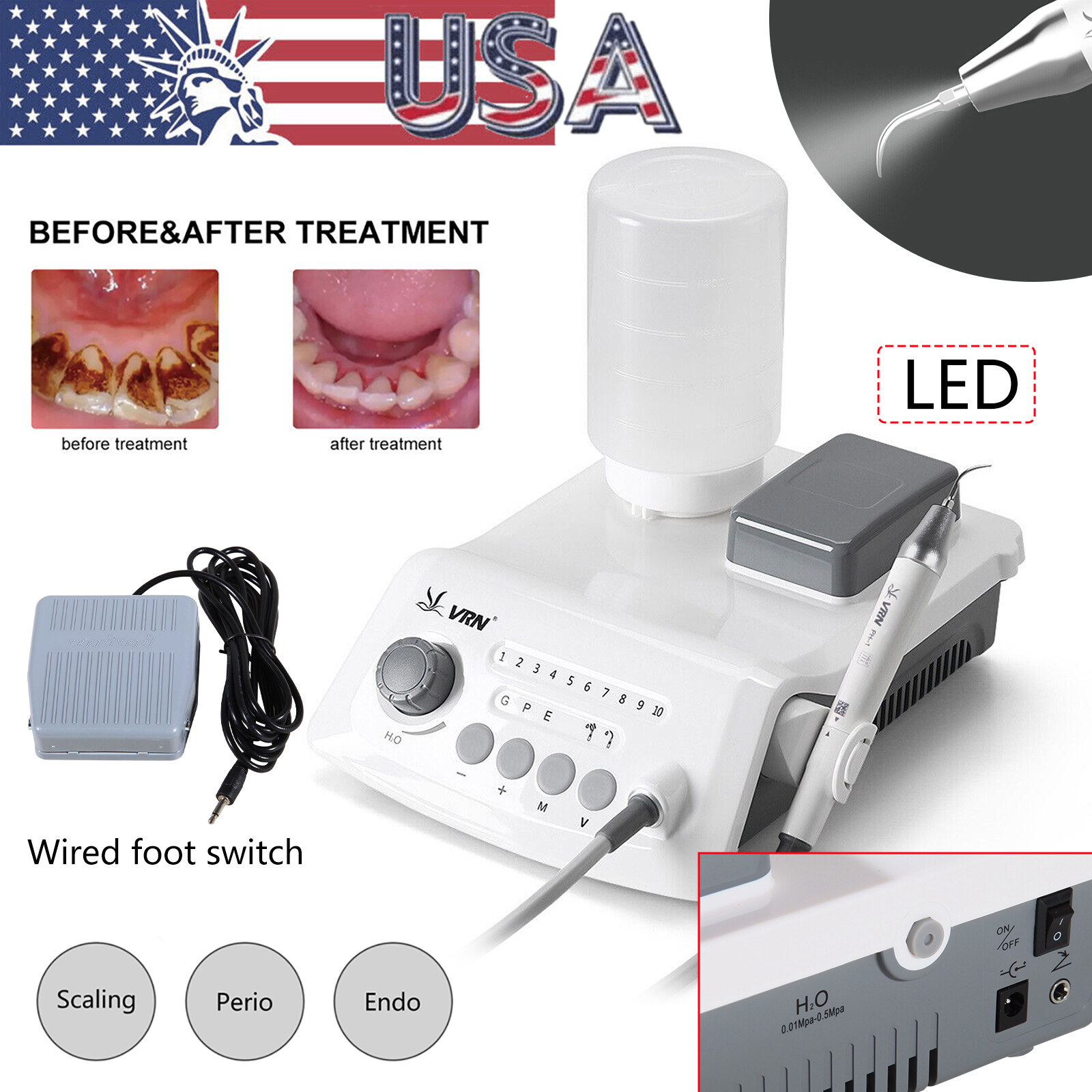 Dental Diode Laser System Wireless laser Pen soft tissue Perio Endo Medical 650