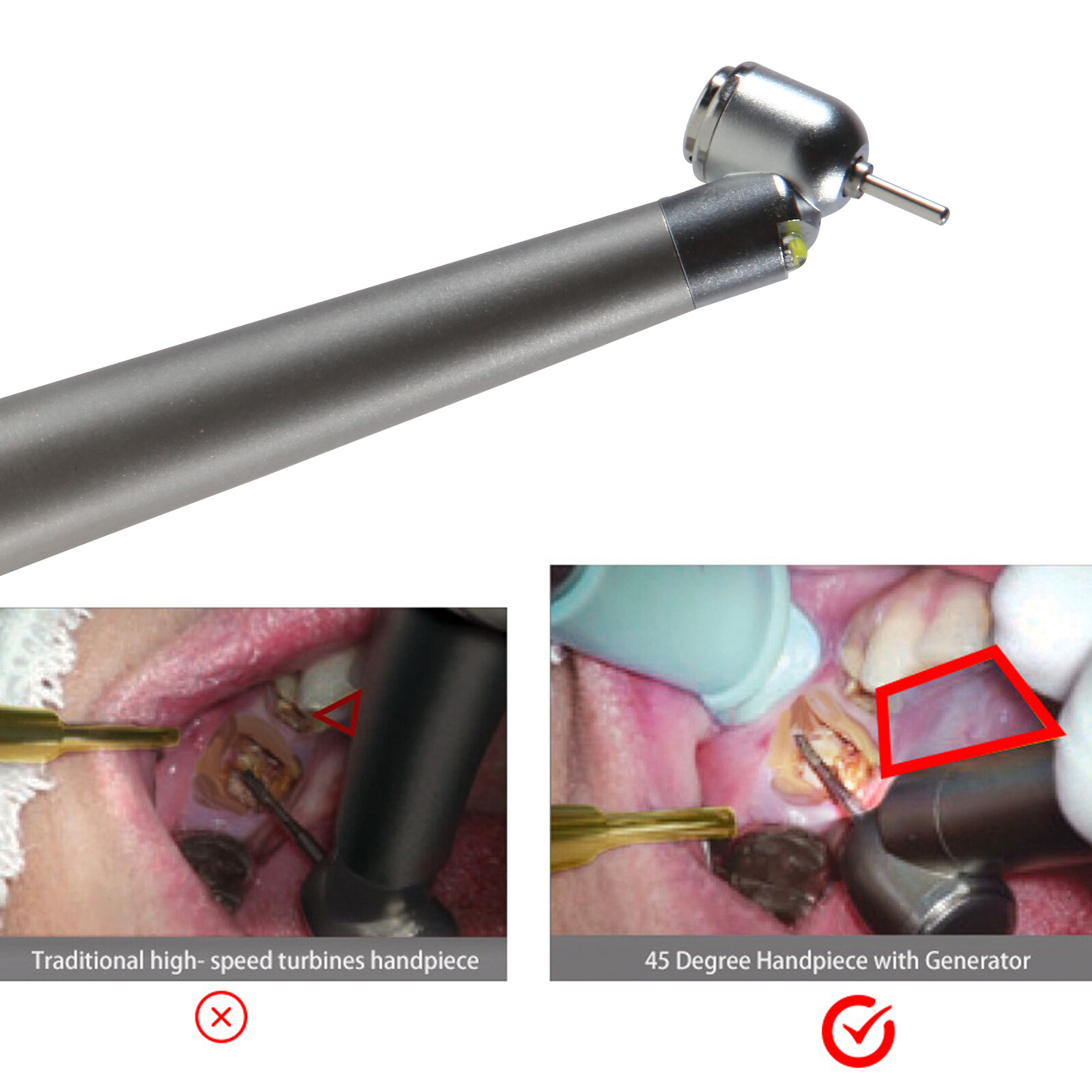NSK Style Dental Surgical Handpiece 45 Degree High Speed 4 H E-generator LED sa