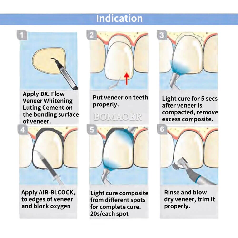 Dental U.LINK Flowable Composite Resin Light Cure & Dual Cure Luting Cement