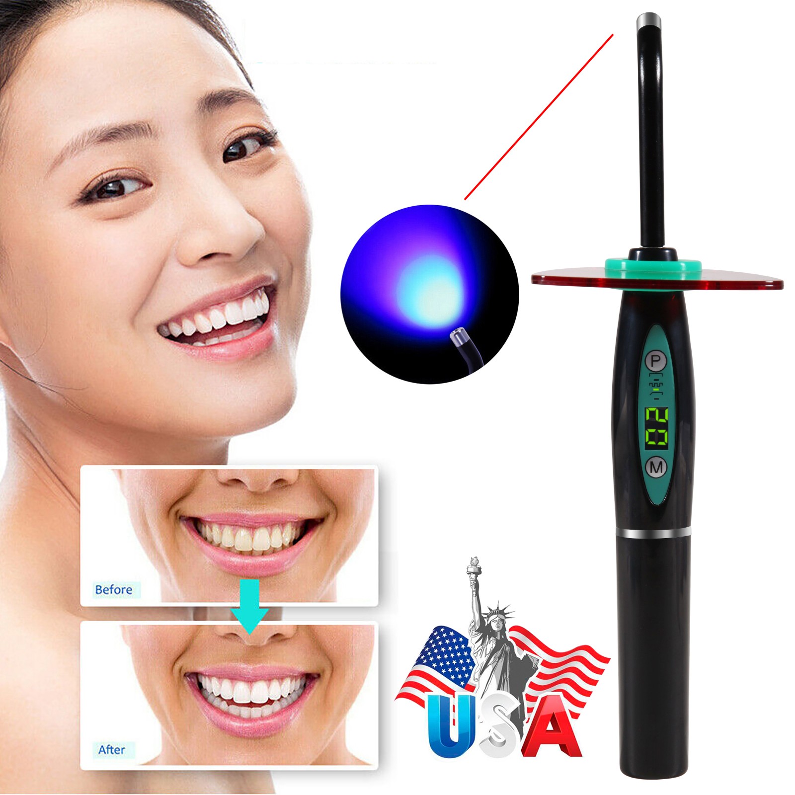 Woodpecker Style Dental Painless Oral Local Anesthesia Device anestesia Pen DE