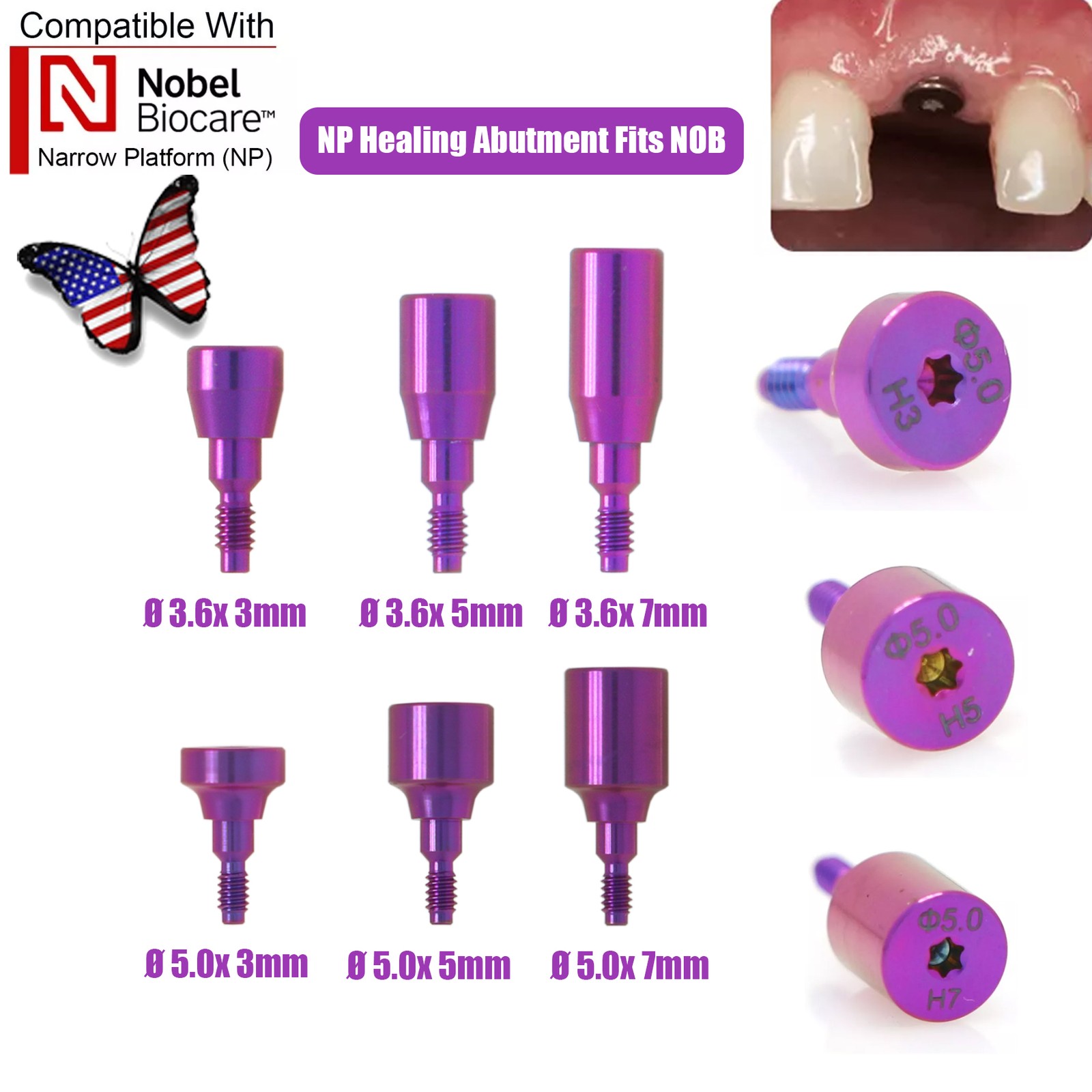 US 5P/k Dental Healing Abutment & Closure Cap Fit Nobel Straumann Hiossen Osstem