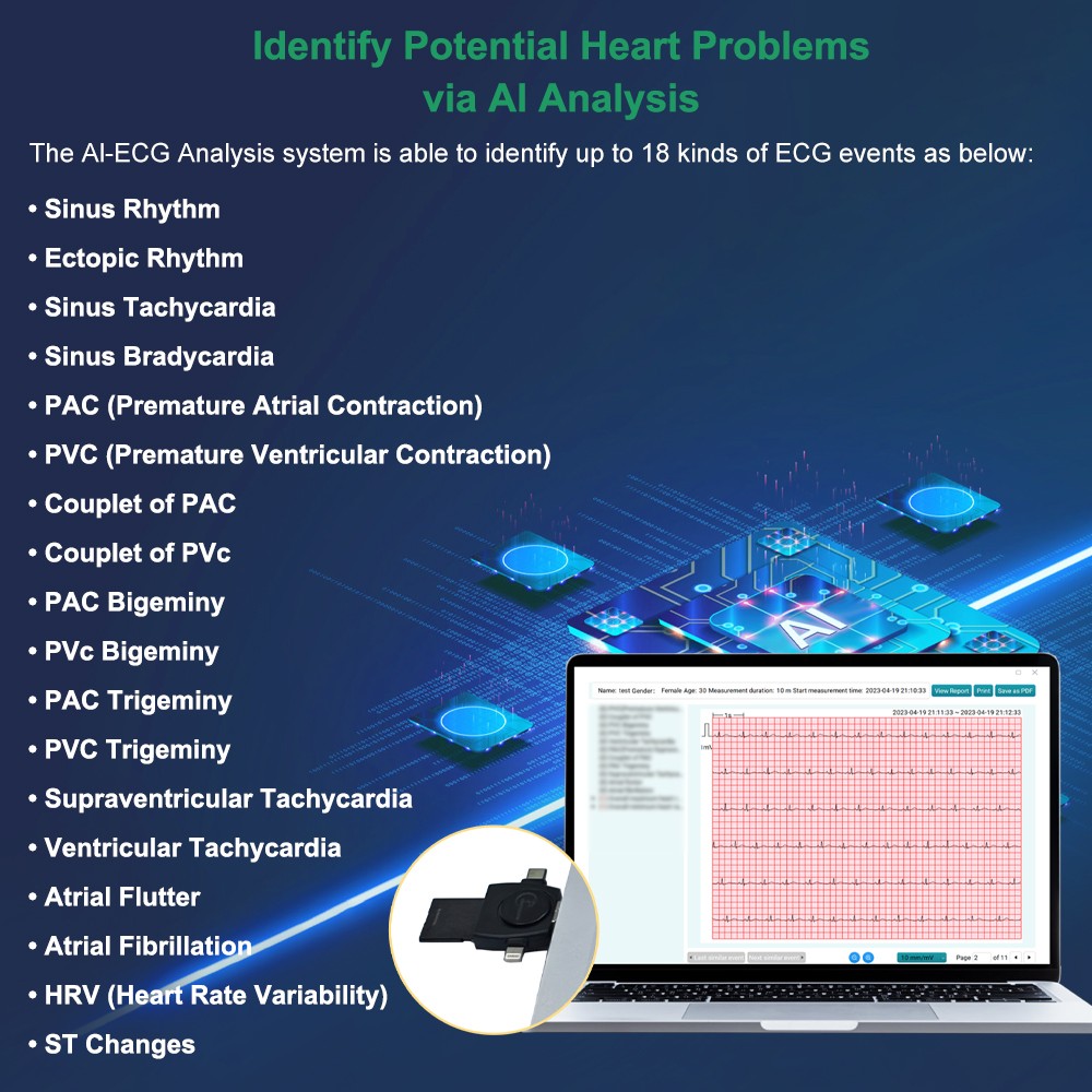 AI Analysis EKG Monitor Heart Monitor 30s/60s/5min Recording with App PC Report