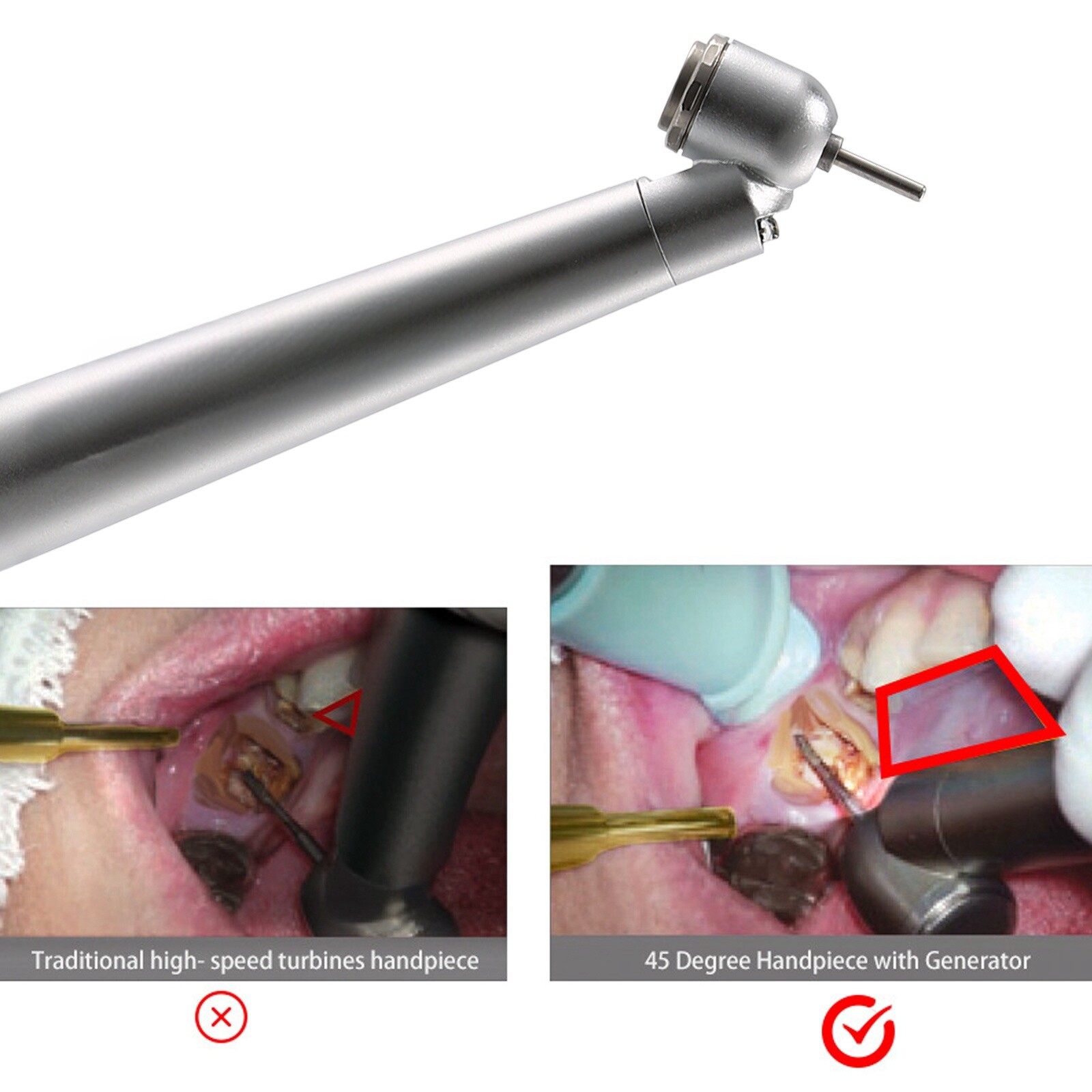 Dental 45° LED Optic High Speed Handpiece E-generator 4 Hole for NSK ASkeadnt