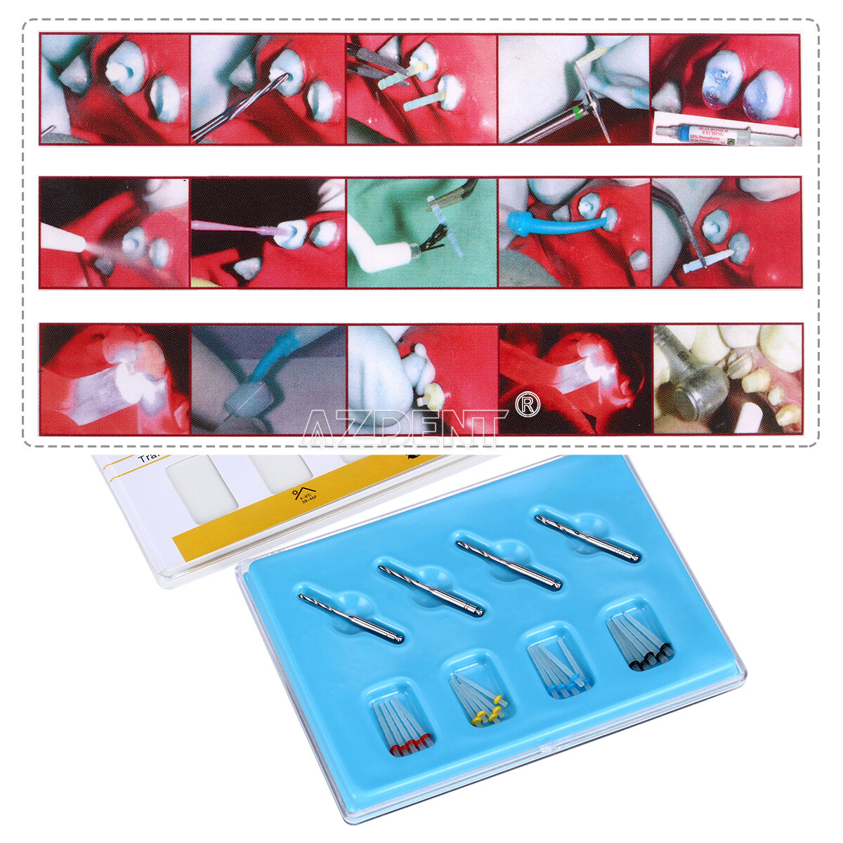 USPS AAA Dental Fiber Post Resin High-intensity Screw Thread Glass +4*Drills FDA