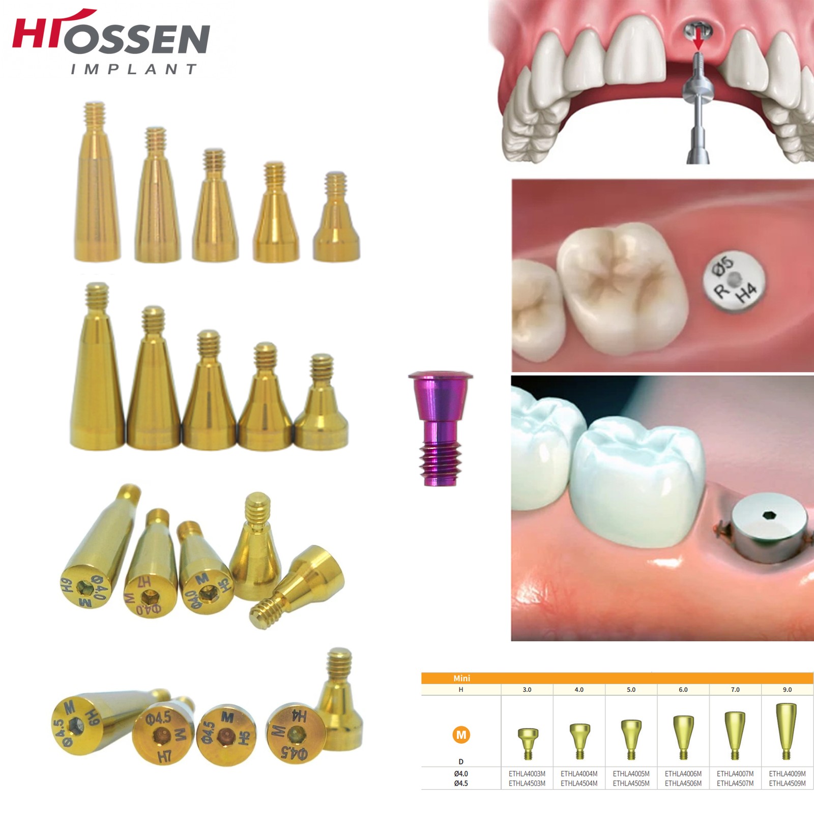 US 5P/k Dental Healing Abutment & Closure Cap Fit Nobel Straumann Hiossen Osstem