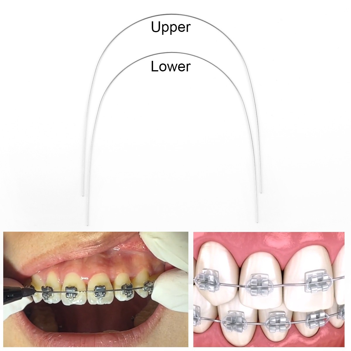 AZDENT Orthodontic Dental Brackets Roth MBT.022/.018 Hooks/Niti Round Arch Wire