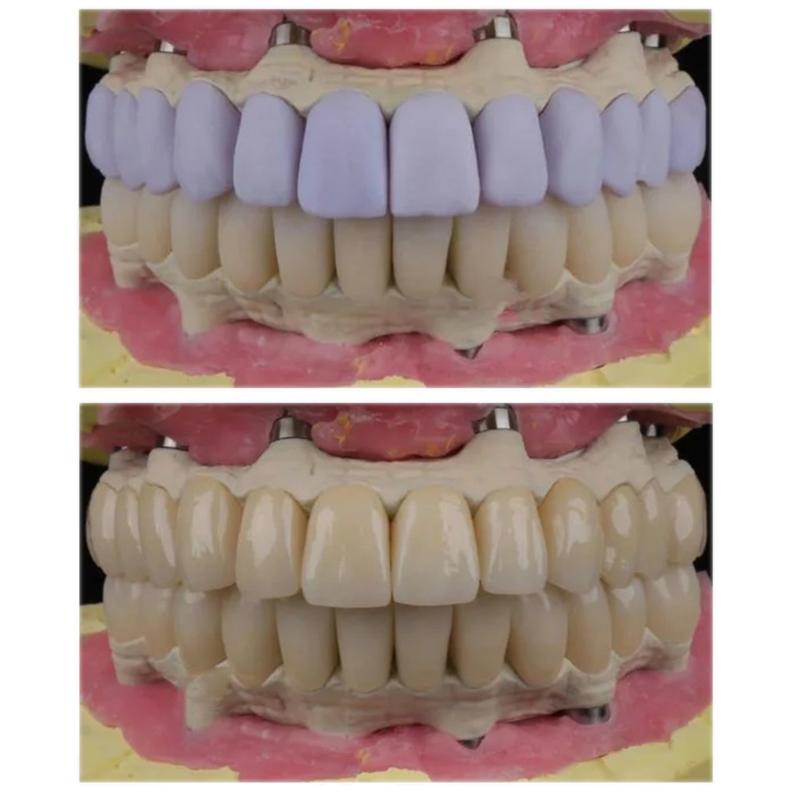 US C14 Emax Dental Glass Ceramic HT LT Lithium Dislicate CAD/CAM Cerec Blocks