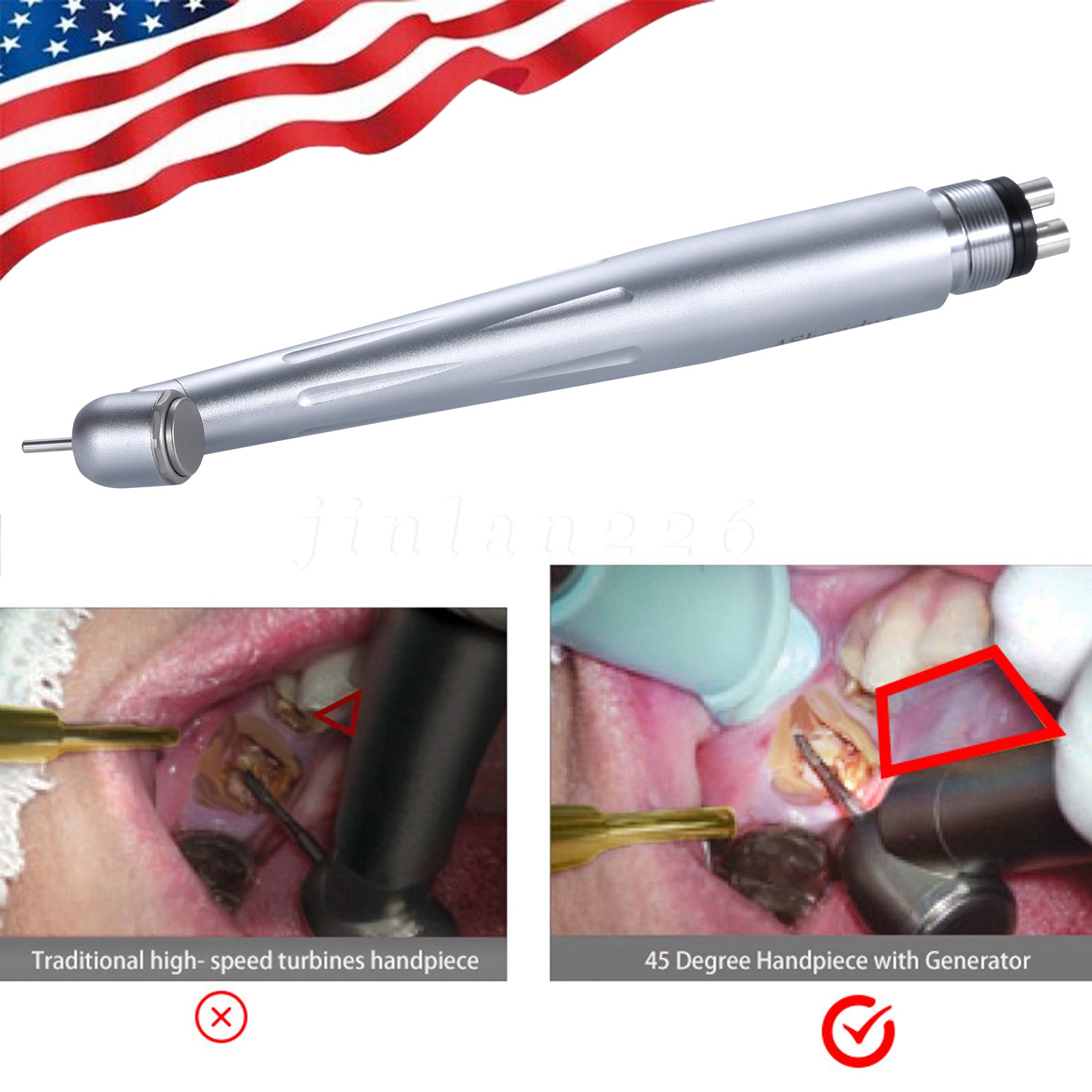 CX207G Dental Cartridge Turbine Rotor Fit COXO-GN/GK/GS/GW Fiber Optic Handpiece